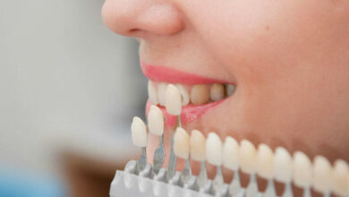 Implante Dentário Gratuito Pelo SUS